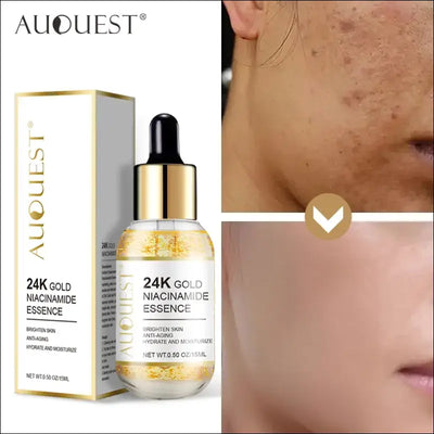 24k gold niacinamide serum - dark spot remover & moisturizer Default Title