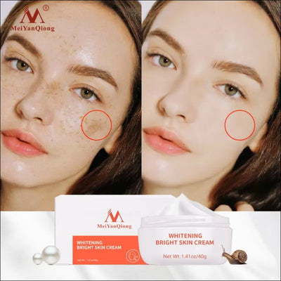 Powerful whitening freckle cream remove acne spots melanin dark spots face lift firming face skin Russian Federation