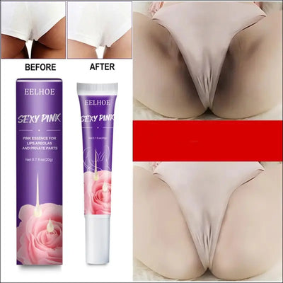 Women skin whitening cream remove melanin emulsion brighten inner thigh whiten butt knee private